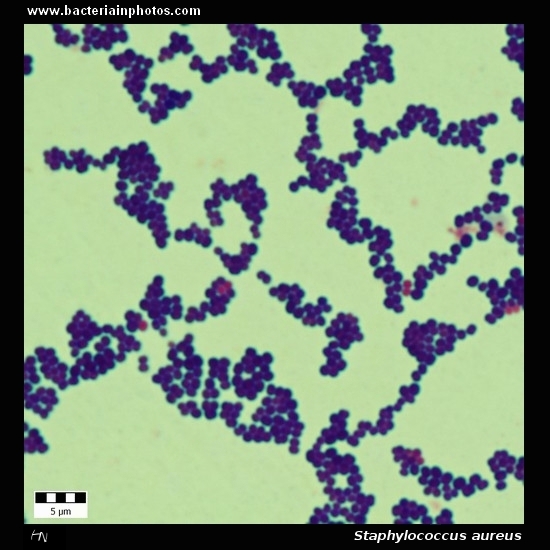 Staphylococcus aureus    
                         microscopy, gram-positive bacteria